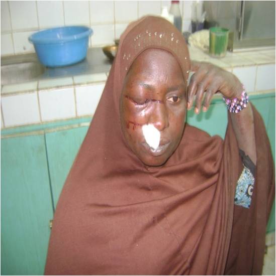 Femme rurale nigerienne victime de violence