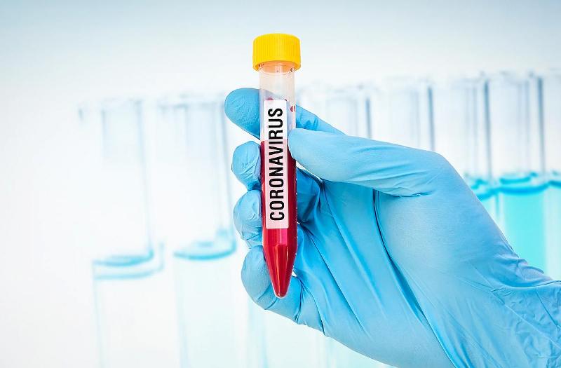 coronavirus blood test